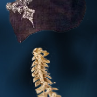 SpinE